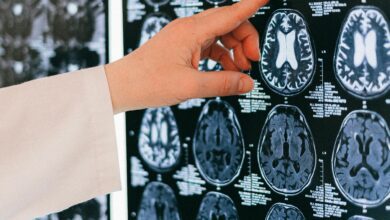 microplastics in brains